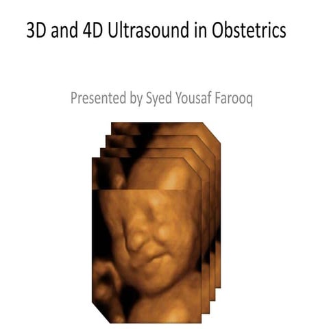 3D and 4D ultrasound in obstetrics
