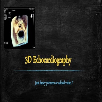 3D Echocardiography