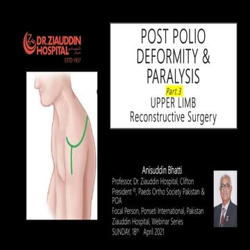 Post Polio residual Palsy & Deformities part3 Upper limb