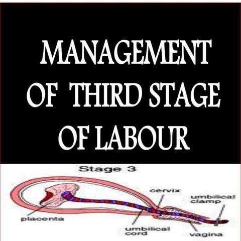 3rd stage of labor.ppt
