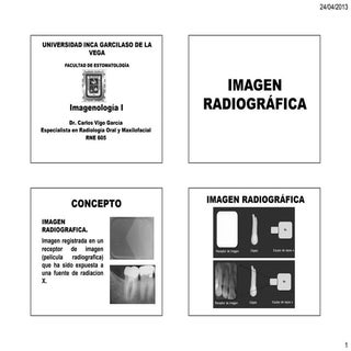 4. imagen radiografica. formacion. ...