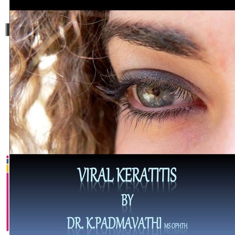 4.fungal and viral keratitis