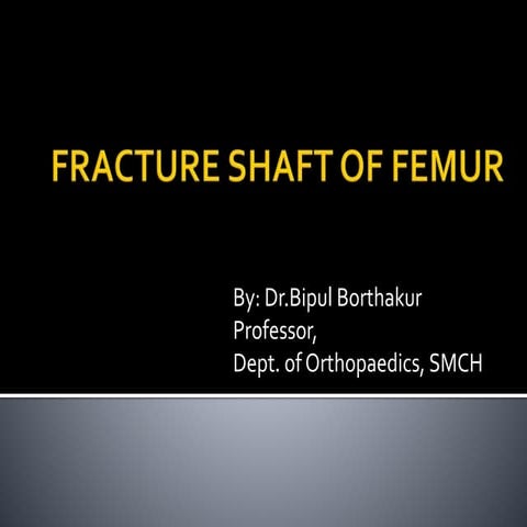 Fracture shaft of femur
