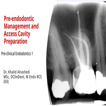 Endodontic Access Opening and Canal Location | PDF