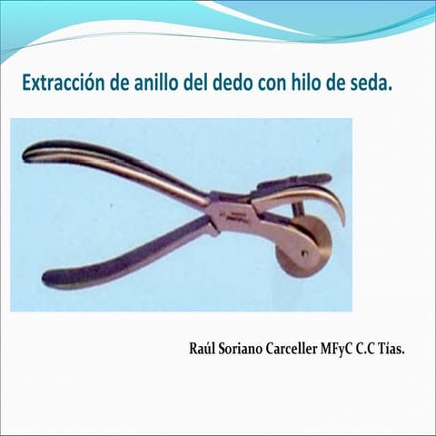 Extracción de anillo del dedo con hilo de