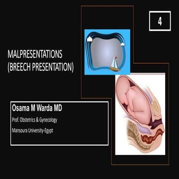 4 malpresentations.warda( 4)-BREECH