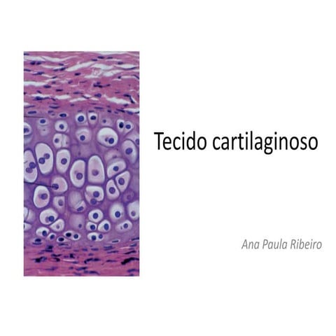 4.tecido cartilaginoso