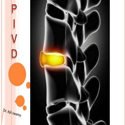 Pivd ppt | PPTX
