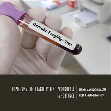 Osmotic fragility test | PPTX