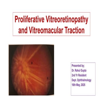 44. Proliferative Vitreoretinopathy and Vitreomacular Traction.pptx
