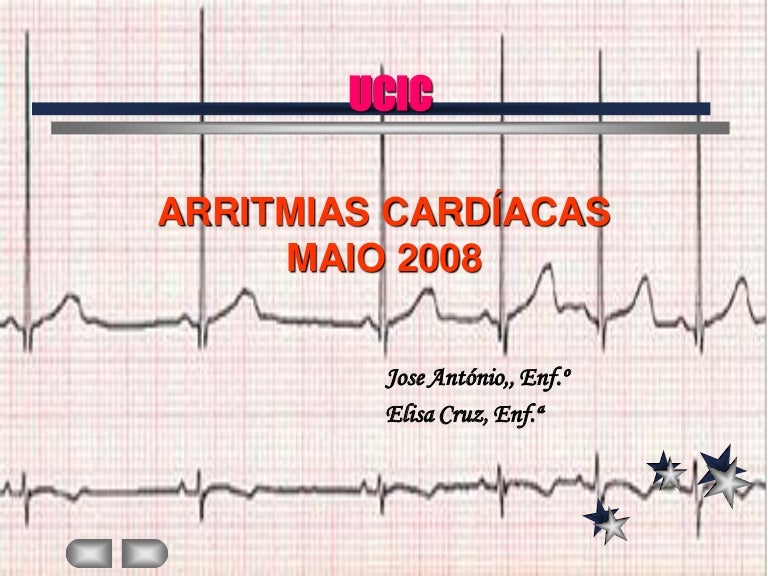 Arritmias cardiacas ecg pdf en
