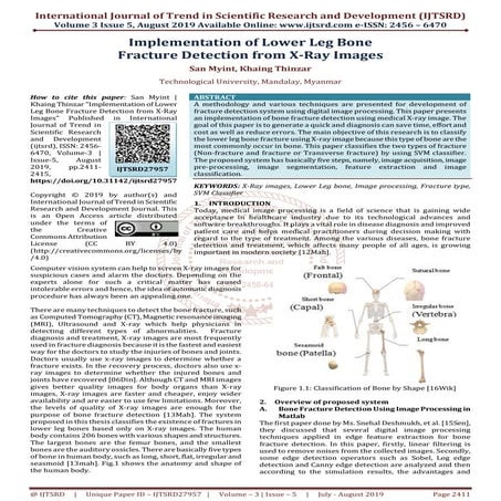 Implementation of Lower Leg Bone Fracture Detection from X Ray Images