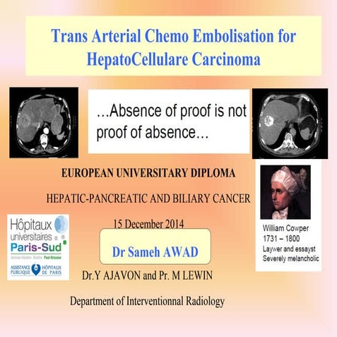 cours chimioembolisation CHC dec 2014
