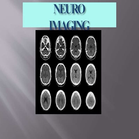 4a. Bimbingan Neuroimaging CT Scan Kepala - Residen.pptx