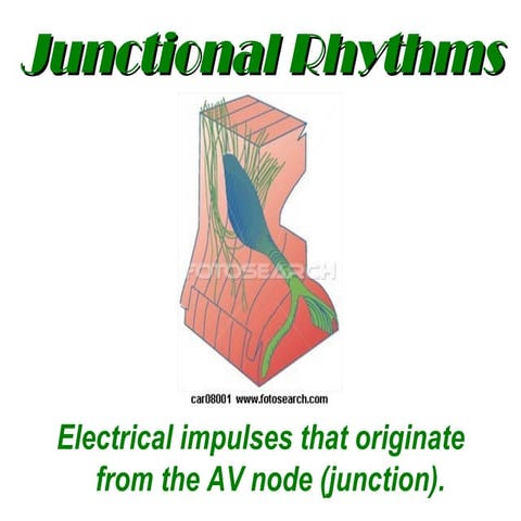 Junctional Rhythms - BMH/Tele