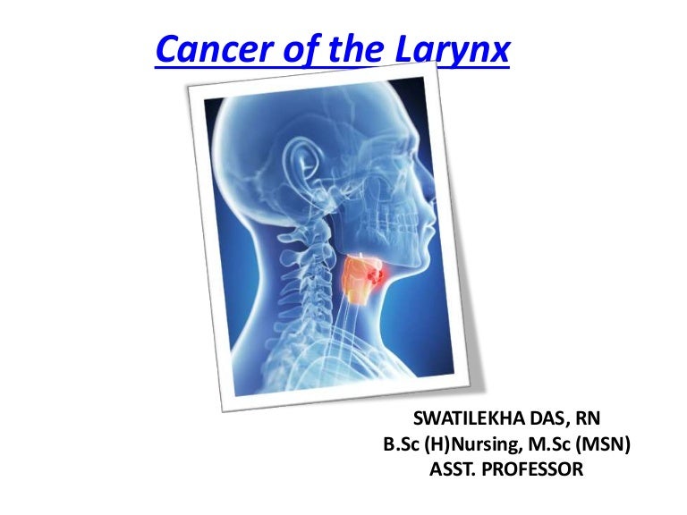 Cancer of Larynx Easy ppt for Nurses