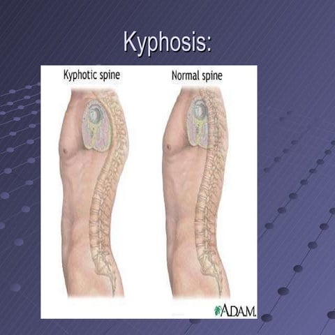 Orthopedics 5th year, 4th lecture (Dr. Hamid)