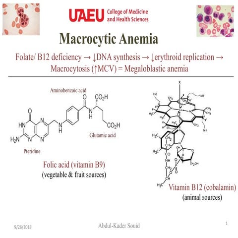 4 macrocytic anemia.ppt