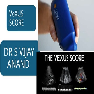 4 VEXUS 2025.pptx pocus abdomen and trauma | PPTX