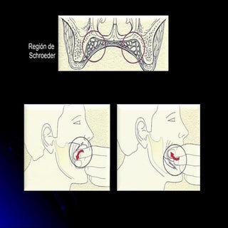 Prueba de rodetes y registros en pr...