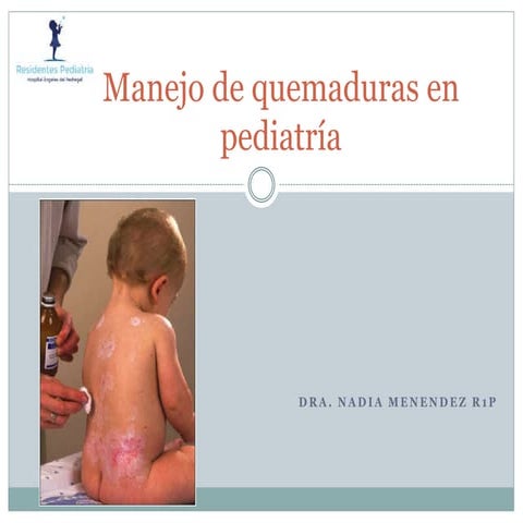 Quemaduras en Pediatría por Nadia Menéndez Auld