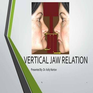 Vertical jaw relation in Complete Dentures- Kelly