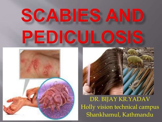 Scabies | PPT