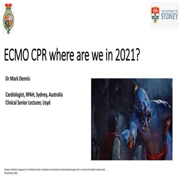 ECMO CPR