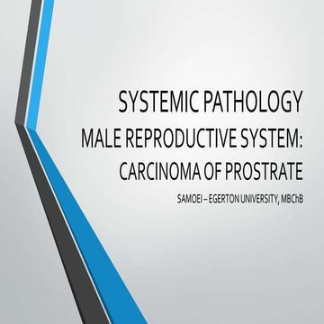 5. CARCINOMA OF PROSTRATE.pptx