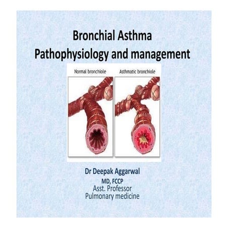5. Bronchial asthma  treatment and prognosis  .pdf