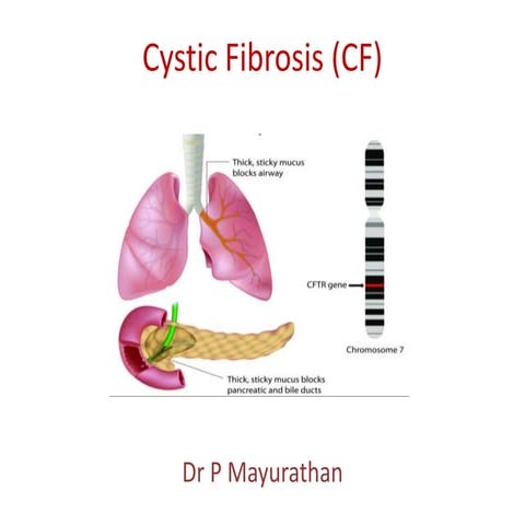 Cystic Fibrosis and its  Pathophysiology