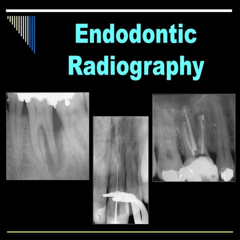 Endodontic radiography.................. | PPTX