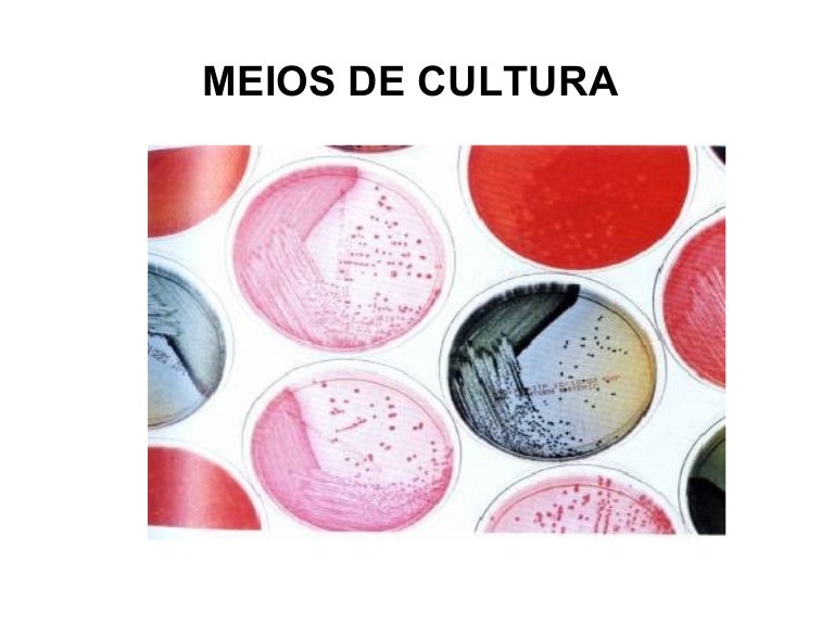 Em Um Meio De Cultura Especial A Quantidade