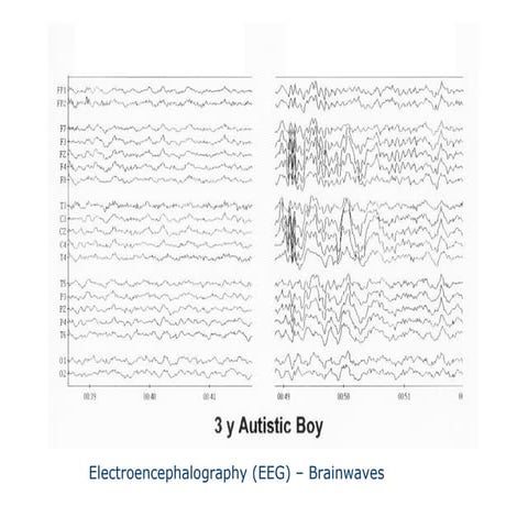 547.02 intro to eeg