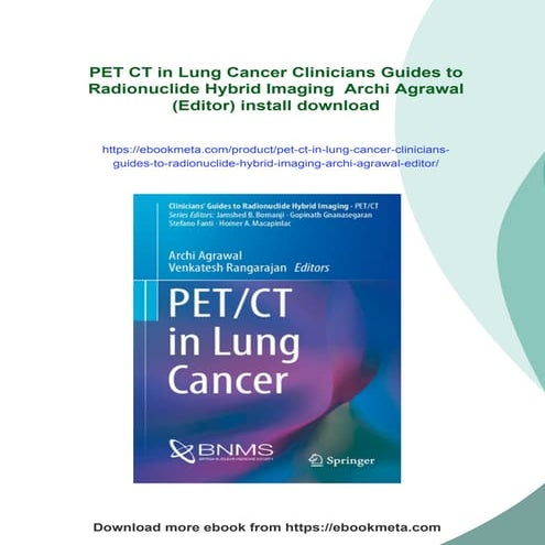 PET CT in Lung Cancer Clinicians Guides to Radionuclide Hybrid Imaging  Archi...