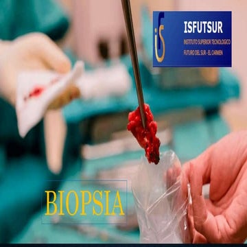 biopsia