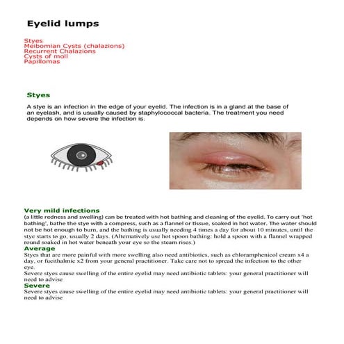 OSCE ophthalmology examination & answers | DOCX
