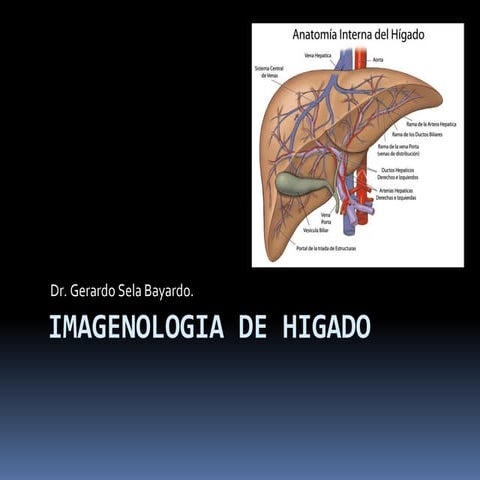 IMAGENOLOGIA DE HIGADO Y VIAS BILIARES 2014 2