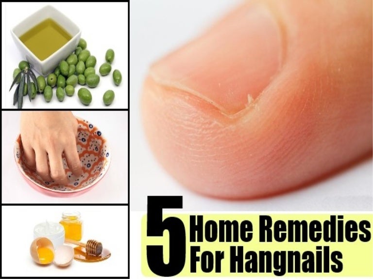 5 Home Remedies For Hangnails