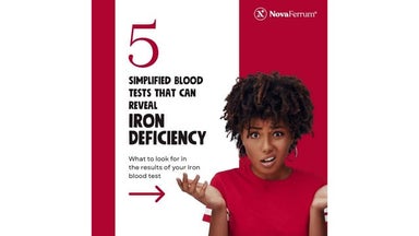 5 Simplified Blood Tests that can Reveal Iron Deficiency