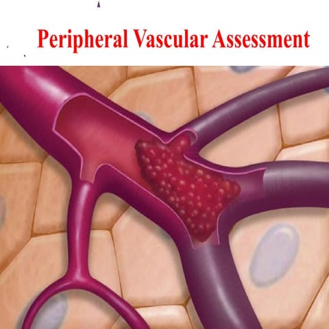 Peripheral Vascular Examination | PPT