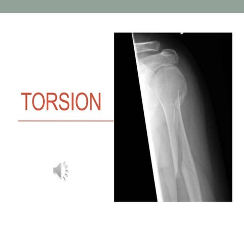 5 torsion