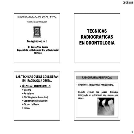 6. tecnica rx bisectriz y paralela