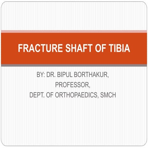 Fracture shaft of tibia