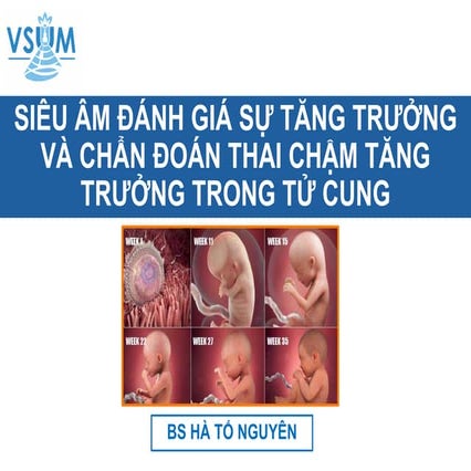 6.SA ĐÁNH GIÁ SINH TRẮC HỌC VÀ SỰ TĂNG TRƯỞNG- BS NGUYÊN.pdf