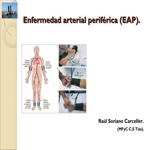 6. enfermedad arterial periférica.