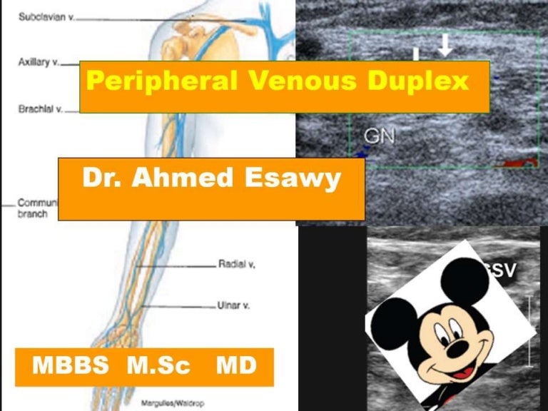 6 peripheral venous duplex superfiscial venous system in lower limb