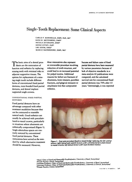 Vonlay; A paradigm shift in post endodontic restoration: A case report ...