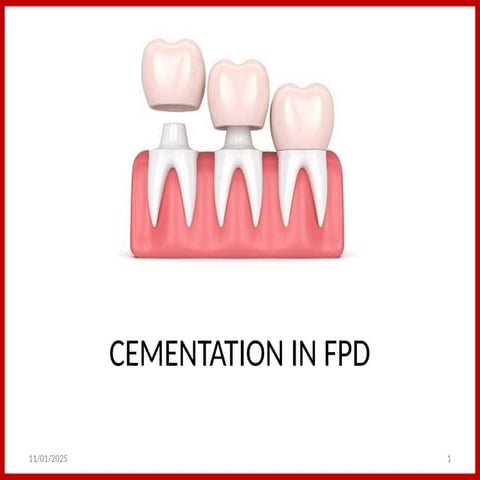 647514154-CEMENTATION protocolIN-FPD.pptx