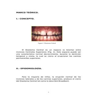 65919752 monografia-de-diastema-cen...
